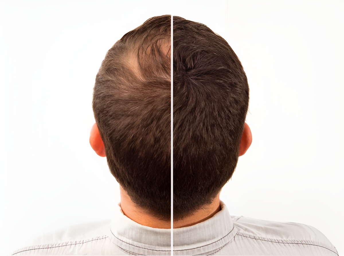 Toppik Hair Building Fibers 27.5g Black | Instant Fuller & Thicker Hair for Men & Women | Natural Hair Concealer for Thinning Hair - Image 4